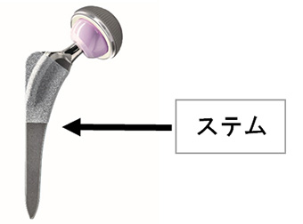 ステム　イメージ